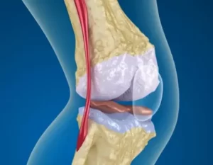 Joint Glide Benefits